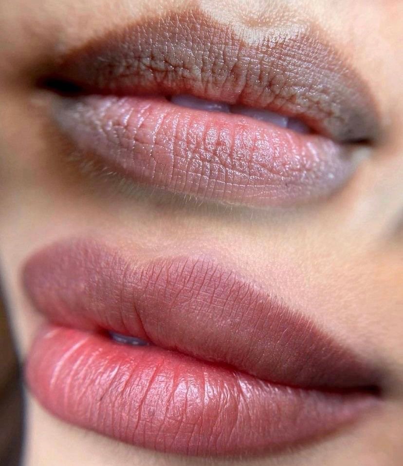 Corrección de labios oscuros con micropigmentación en Valladolid – Antes y después