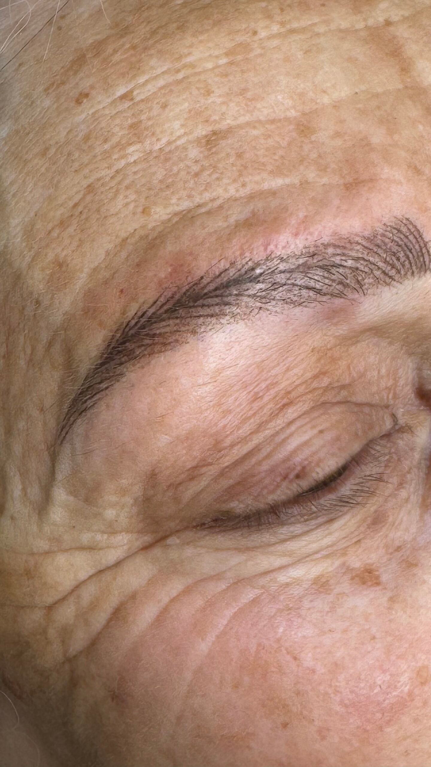 Tratamiento facial Carbon Peel en Valladolid para rejuvenecimiento de la piel