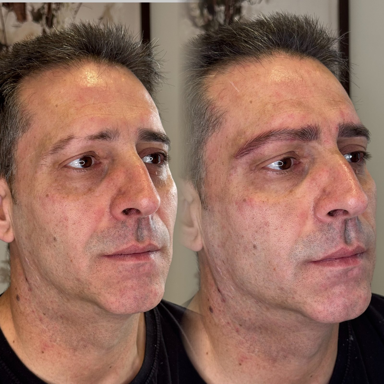 Antes y después de micropigmentación de cejas en hombre en Valladolid